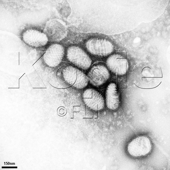 Mikroskopische Aufnahme: Negativkontrastierung: Parapoxvirus 
