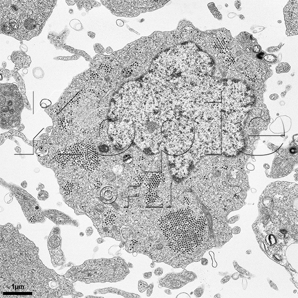 Mikroskopische Aufnahme: Ultradünnschnitt: Infizierte U4.4 -Zelle