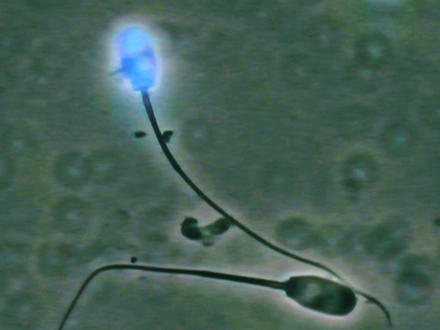 Defekte Plasmamembran (blau), (© FLI) Defekte Plasmamembran (blau), (© FLI)